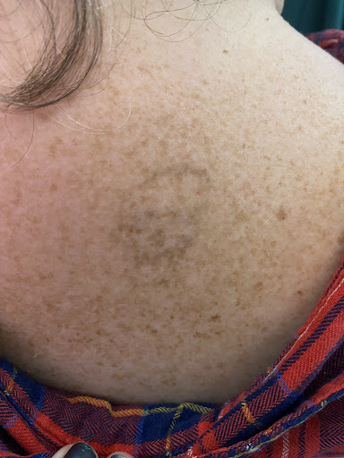 Explore hourglass tattoo ideas, creative tattoo ideas in Lake Jackson, available at Second Chance Laser Tattoo Removal