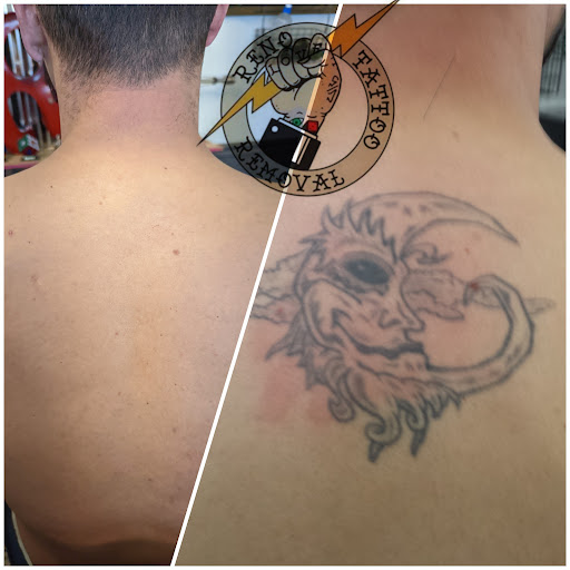 Explore marriage ring tattoo ideas, creative tattoo ideas in Reno, available at Reno Tattoo Removal