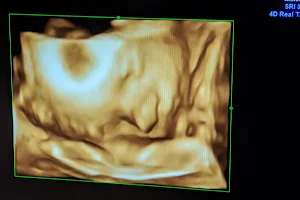 Utah Valley Obstetrics & Gynecology image