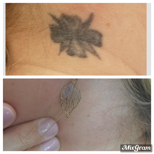 Explore tattoos for your daughter ideas, creative tattoo ideas in Tyler, available at Vanish Laser Aesthetics