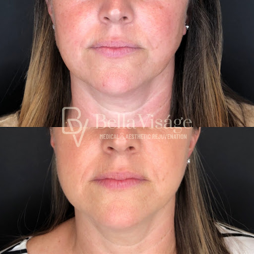 Explore fall leaf tattoo ideas, creative tattoo ideas in Lakeland, available at Bella Visge Medical & Aesthetic Rejuvenation