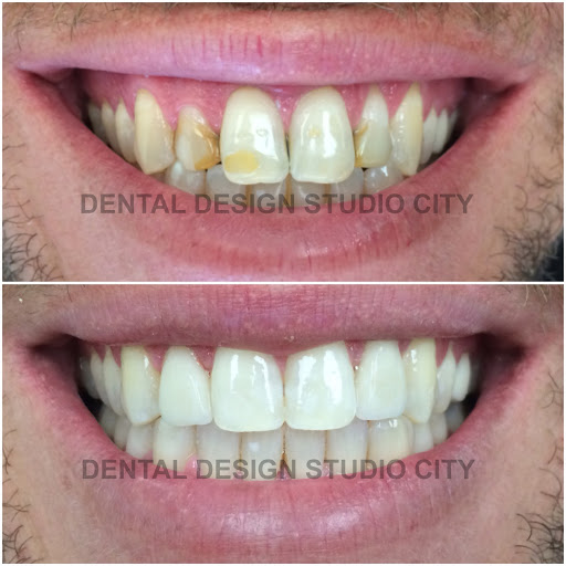 Dental Design Studio City image