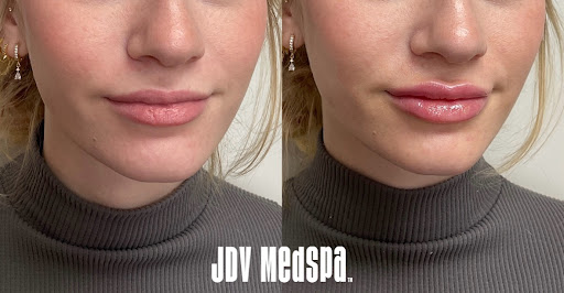 Explore see no evil tattoo ideas, creative tattoo ideas in Canton, available at JDV Med Spa