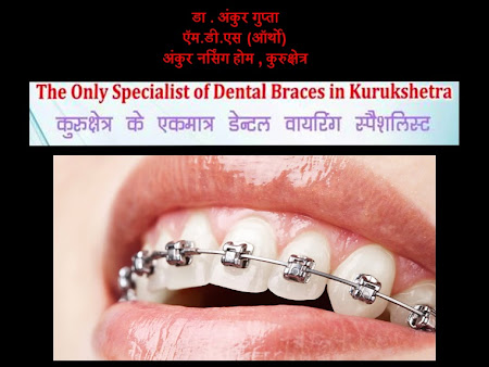 Braces Faces, Ankur Nursing Home - Braces Faces, Ankur Nursing Home