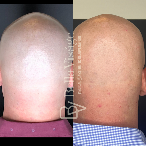 Find best leg tattoo ideas for your next unique tattoo in Lakeland at Bella Visge Medical & Aesthetic Rejuvenation