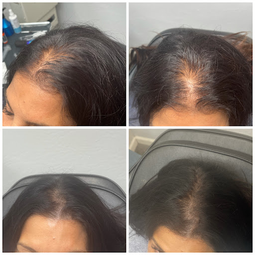 Explore ankle bracelet tattoo ideas, creative tattoo ideas in Roseville, available at NuHair Ink. Scalp MicroPigmentation & Aesthetic Clinic of Sacramento