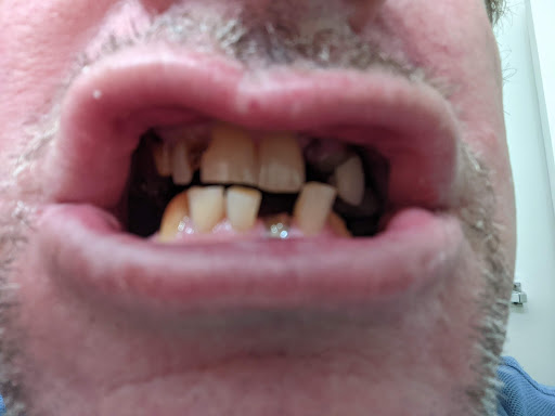 Orthodontist Berkeley