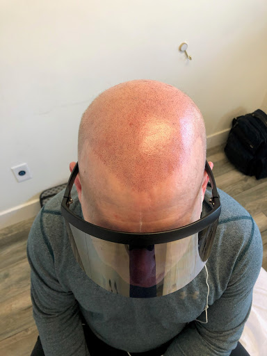 SMP Hair Clinic The Queen Of Scalp image