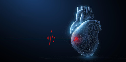 Ischaemic heart disease specialists Houston