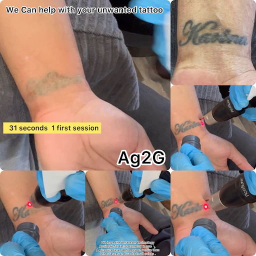 Explore chest tattoos ideas, creative tattoo ideas in New York, available at Ag2g Laser Tattoo Removal & MedSpa