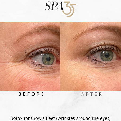 Explore mamba mentality tattoo ideas, creative tattoo ideas in Boise, available at Spa 35 Med Spa