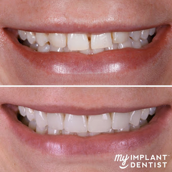 بلمونت لجراحة الأسنان - Belmont Dental Surgery