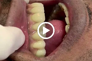 Clínica Arcobelo Odontologia | Implantes | Invisalign | Dentista image