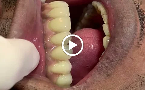 Clínica Arcobelo Odontologia | Implantes | Invisalign | Dentista image