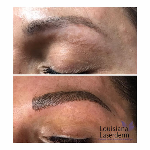 Explore element tattoo ideas, creative tattoo ideas in Baton Rouge, available at Louisiana Laserderm