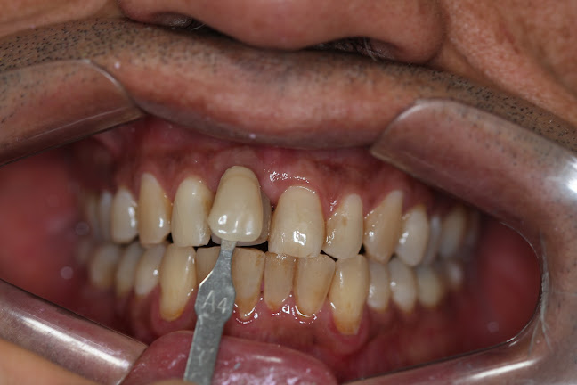 Opiniones de CEDENTY Odontologia Especializada en Quito - Dentista