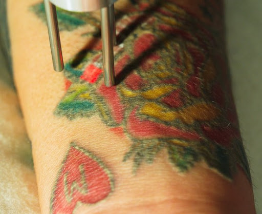 Explore easy tattoo ideas for women, creative tattoo ideas in Covington, available at Northshore Tattoo Removal