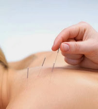 Acupuncture & Natural Health Solutions - Photo 3 - Car repair in Naples, FL, Bonita Springs