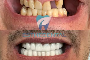 EstheDental - Cosmetic Dentistry in Turkey image