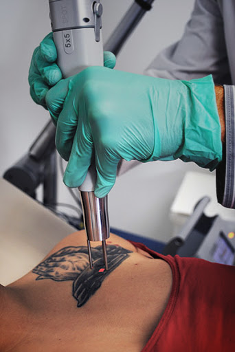 Explore addiction recovery tattoo ideas, creative tattoo ideas in San Diego, available at Evolve Tattoo Removal