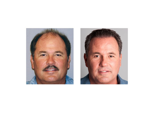 Hair Transplantation Clinic «Bosley Medical - Denver», reviews and photos, 6979 S Holly Cir #275, Centennial, CO 80112, USA