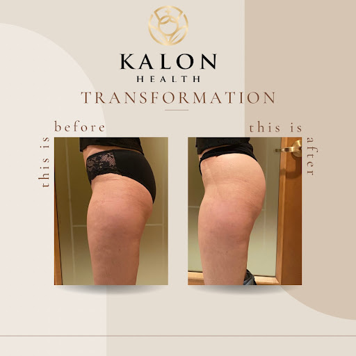 Explore fullmetal alchemist tattoo ideas, creative tattoo ideas in Elizabethtown, available at Kalon Health