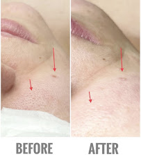 Babyface Skincare & Lash Studio - Photo 2 - Car repair in Temple City, CA, El Monte