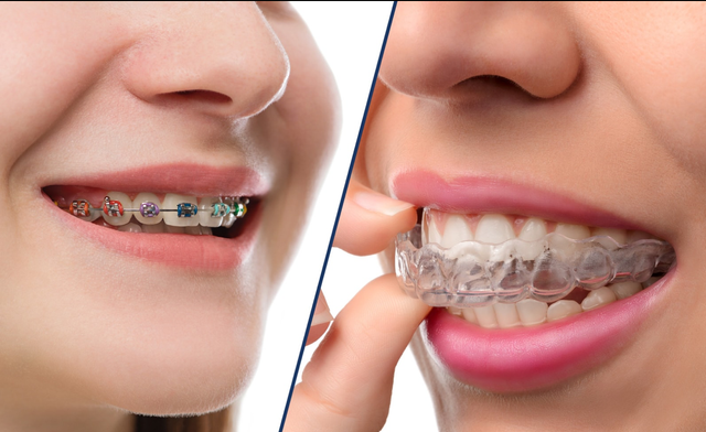 Ortodoncia Invisible Implantes Dentales 3Dent Odontología