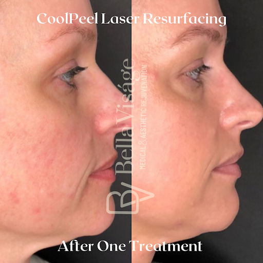 Explore chandelier tattoo ideas, creative tattoo ideas in Lakeland, available at Bella Visge Medical & Aesthetic Rejuvenation