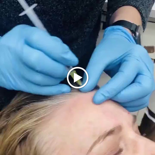 Find small palm tree tattoo ideas for your next unique tattoo in Eugene at Absolute Laser MD