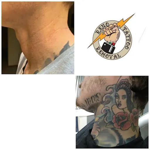 Explore symbol small tattoo ideas, creative tattoo ideas in Reno, available at Reno Tattoo Removal