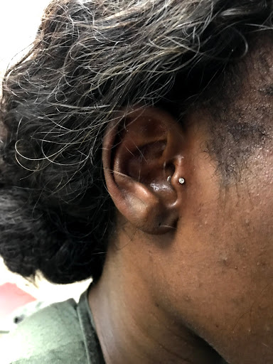 Explore stitching tattoo ideas, creative tattoo ideas in Dallas, available at Fly Ink, Inc.