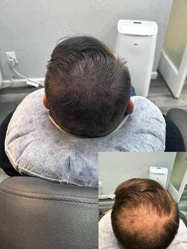 Explore llama tattoo ideas, creative tattoo ideas in Roseville, available at NuHair Ink. Scalp MicroPigmentation & Aesthetic Clinic of Sacramento