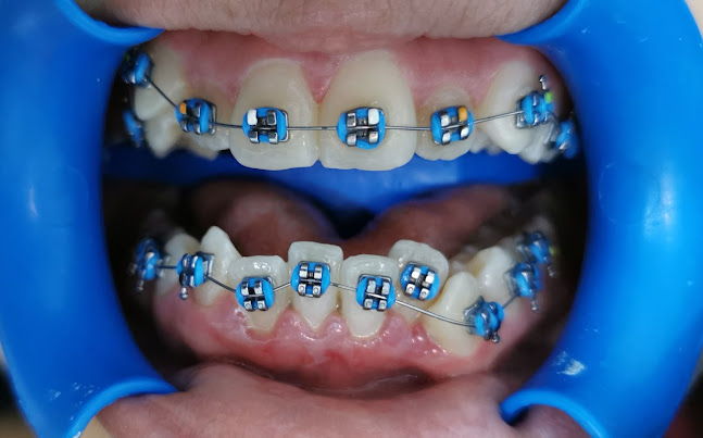 My Dentiss Consultorio DENTAL - Dentista