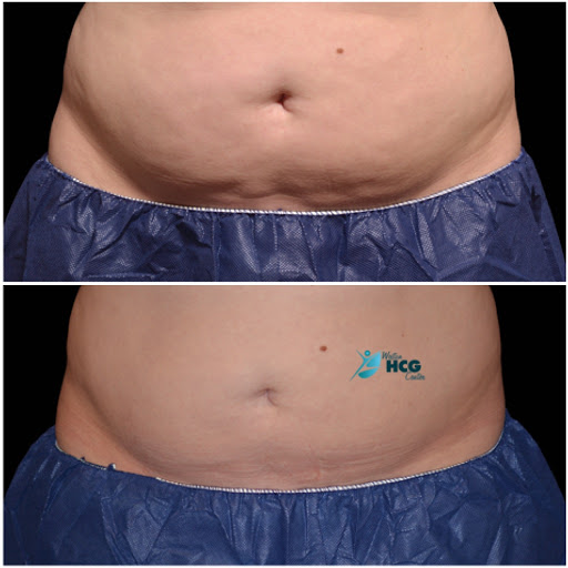 Weight Loss Service «Weston HCG Center», reviews and photos, 1654 Bell Tower Ln, Weston, FL 33326, USA