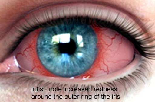 Eye Care Center «Master Eye Associates», reviews and photos, 12700 Hill Country Blvd s, Bee Cave, TX 78738, USA