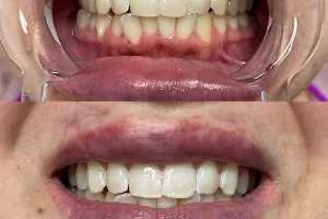All Smiles Teeth Whitening LLC image