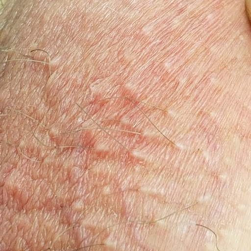 Hair Removal Service «Aesthetics by Karen Marlise DBA Tampa Bay Laser Hair Removal», reviews and photos, 10701 Village Green Ave, Seminole, FL 33772, USA