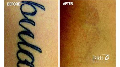 Explore wizard tattoo ideas, creative tattoo ideas in Phoenix, available at Removery Tattoo Removal & Fading