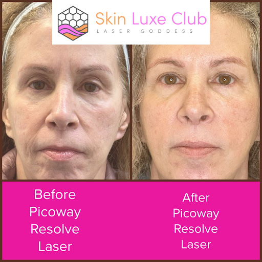 Explore ankle tattoo ideas female, creative tattoo ideas in Bayside, available at Laser Goddess