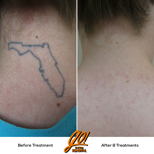 Find moth tattoo ideas for your next unique tattoo in Allentown at Removery Tattoo Removal & Fading