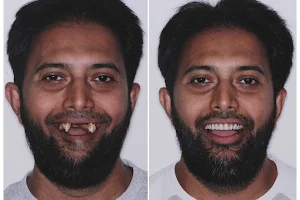 Dr.Bhatti's Dental Implant Centre image