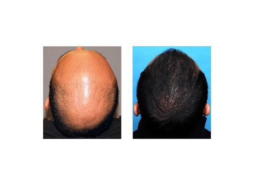 Hair Transplantation Clinic «Bosley Medical - Denver», reviews and photos, 6979 S Holly Cir #275, Centennial, CO 80112, USA