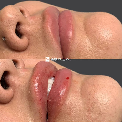 Explore side of head tattoo ideas, creative tattoo ideas in Whittier, available at Skin Perfect Medical Aesthetics