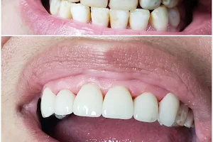 Dahle Dental image