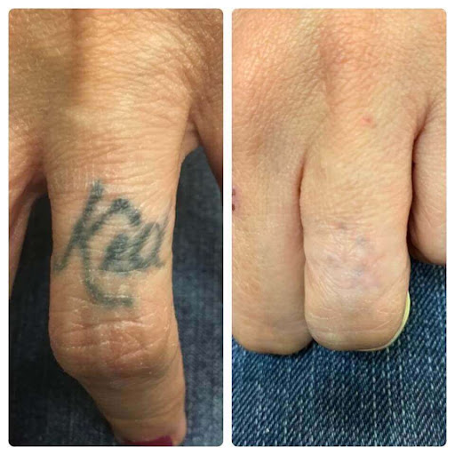 Explore inside of arm tattoo ideas, creative tattoo ideas in Houston, available at Clean Canvas Laser