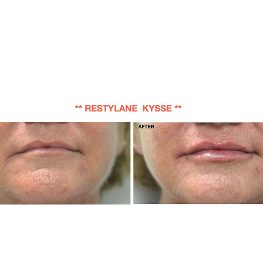 Explore forearm tree tattoo ideas, creative tattoo ideas in Chino, available at SoCal Body Institute