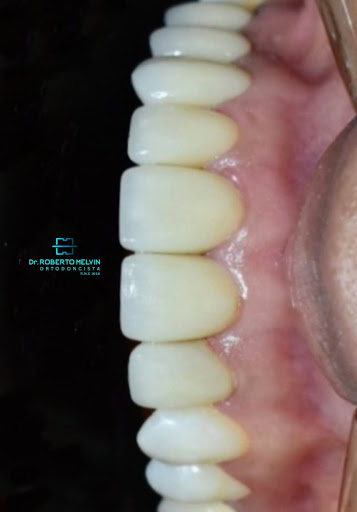 Roberto Melvin - Ortodoncia y Estética Dental