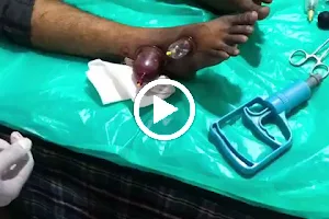 HIJAMA CUPPING THERAPY DISEASE BASED TREATMENT CENTRE image