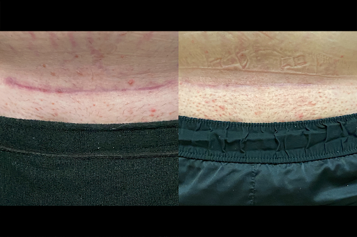 Explore leg sleeve tattoo ideas men, creative tattoo ideas in Brookfield, available at Milwaukee Laser & Body Aesthetics